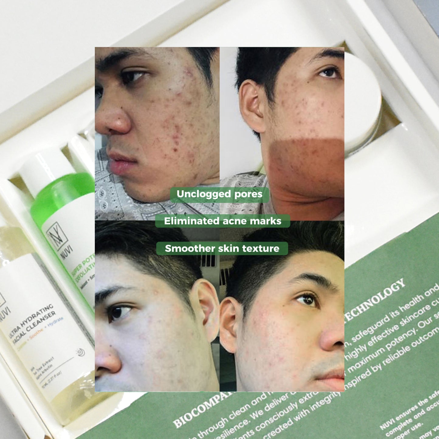 NUVI Super Potent Skin Regenerating Bundle
