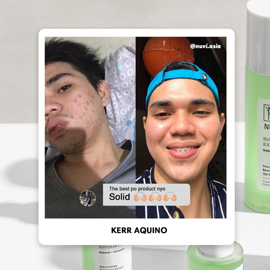 Super Potent Skin Regenerating Bundle