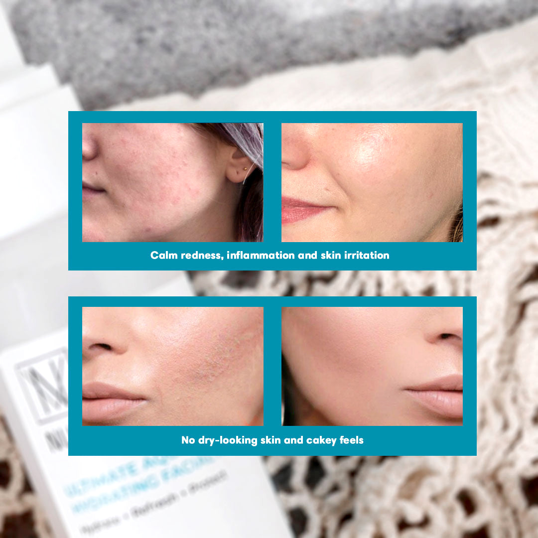 NUVI Ultimate Aqua Hydrating Facial Mist